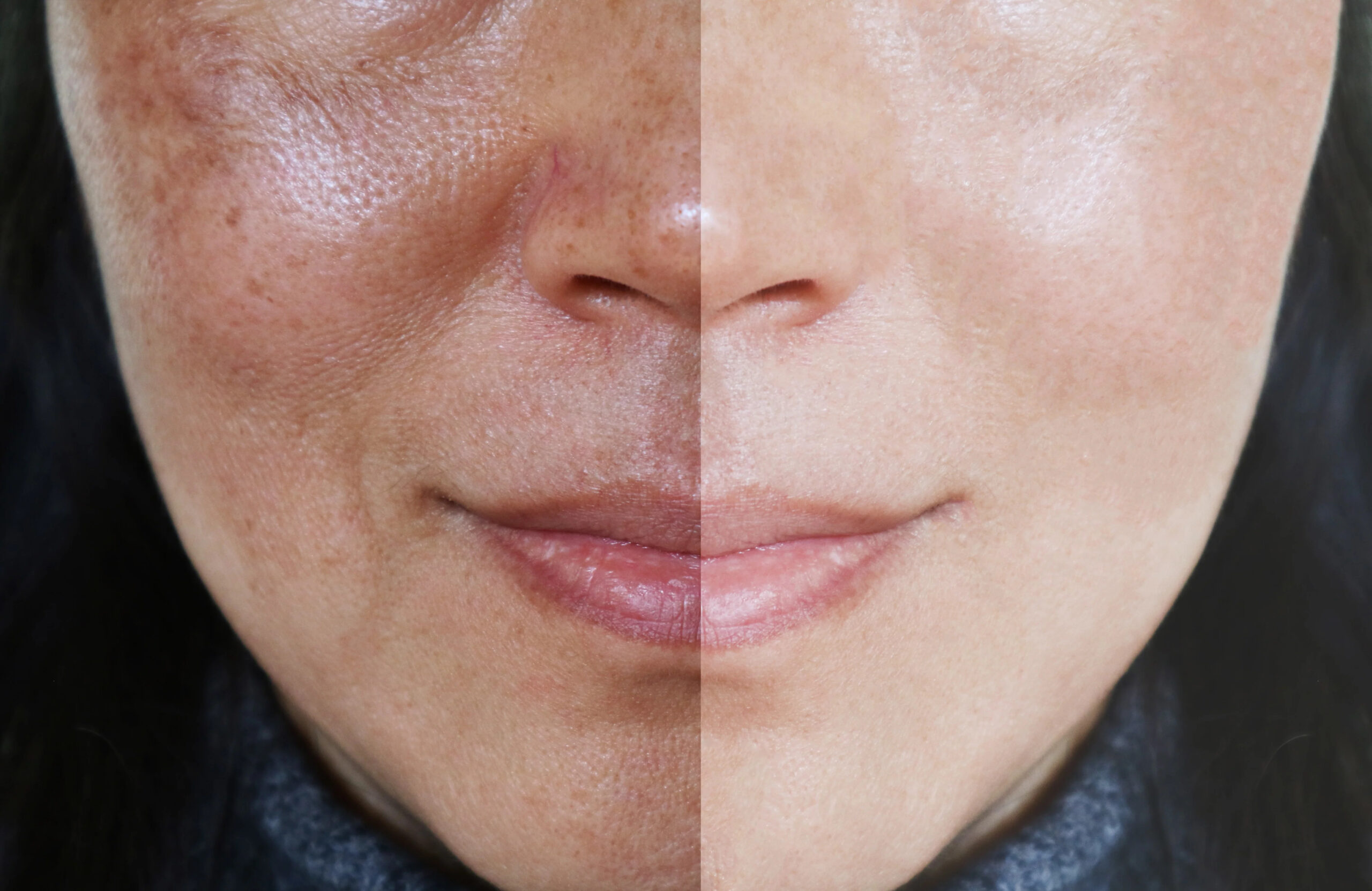 https://sonyadakar.com/collections/dark-spot-treatment