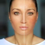 Uneven Skin Tone? Dark Spot Treatments Offer Targeted Care