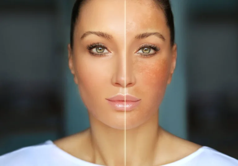 Uneven Skin Tone? Dark Spot Treatments Offer Targeted Care